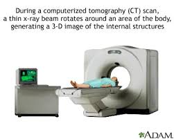 cat scan