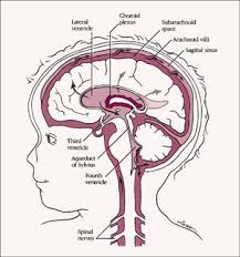 [1] Cerebral palsy