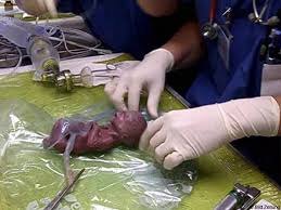 BERITA - Berita Dunia