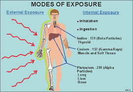 radiation exposure