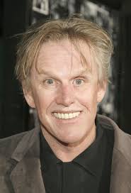 Gary Busey Eyelid Surgery