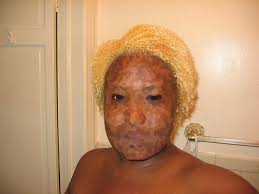 bleach hair