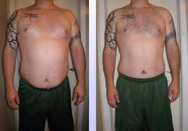 As you know, the HCG Diet
