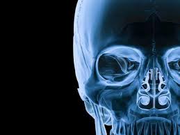 Radiology
