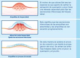 bild lippenherpes Herpes Labial, ¿Que es?