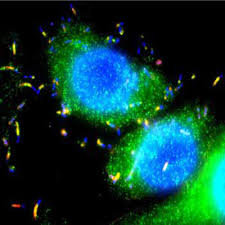 of Listeria monocytogenes
