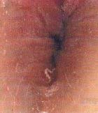 Photo of a thread worm