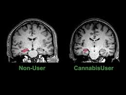 effects of marijuana