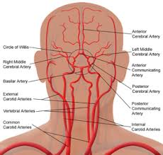 The different types of headaches and their treatments