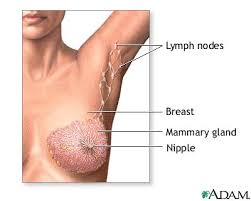 lymphatic cancer