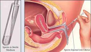 injection woman