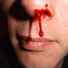 external image 1_1_small.jpg