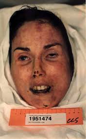damn terri schiavo debate
