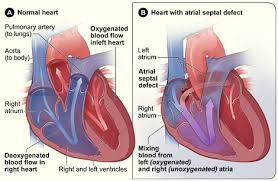 normal heart