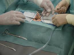 Appendectomy Simulator