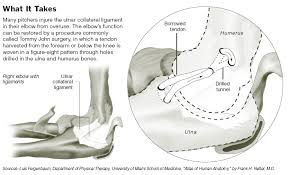 More on Tommy John surgery