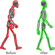 external image before_after_posture.gif