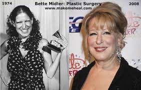 bette midler