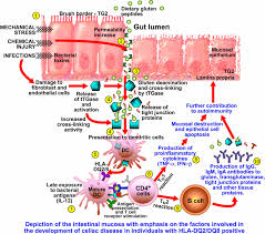 Celiac Disease Gene Mediated