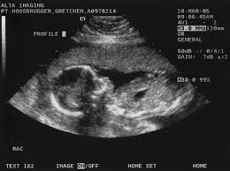 ultrasound at 16 weeks