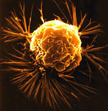 breast-cancer-cell2