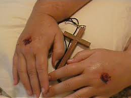 Summer 2005 159 Stigmata