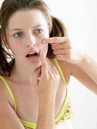pimples