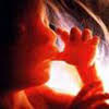 Aborto: Asesinando los Derechos