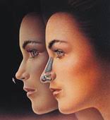 Rhinoplasty Bryan Texas