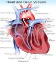HEART TRANSPLANT Surgery and Procedure Information by MedicineNet.