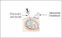 <b>Fetoscopy</b>. drugline.org