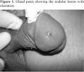 affect the <b>male</b> and the
