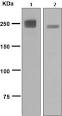 Anti-cardiac <b>Myosin type II</b>
