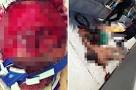 Miami cannibal attack was voodoo curse says girlfriend - Mirror Online