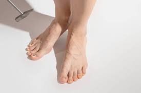 Image result for piedi sporgenti