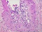 Arterial <b>Foam Cells</b>