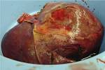 scotts-<b>liver</b>-cropped.JPG