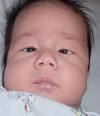 <b>Strabismus</b>