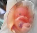 Come Superare un <b>Aborto Spontaneo Interno</b>