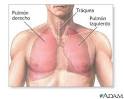 Anatomía del <b>pulmón</b> normal