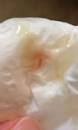 UPDATE* Implantation Bleeding or Spotting? Graphic Photo... - July ...