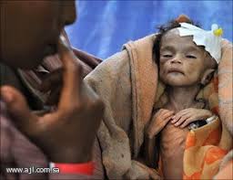 مجاعة الصومال .. اين انت ياعمر بن عبدالعزيز ؟؟ Images?q=tbn:ANd9GcQUfCC9Fay13hS5CIO_CssVb4mzIYkaPV_4lUALtZu7Iyk4fRwwsw