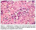<b>meningoencephalitis</b> caused