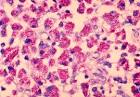 File:<b>Mycobacterium</b>