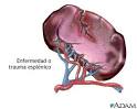 portal e <b>hiperesplenismo</b>