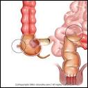 DIVERTICULITIS Medical, Health & Disease Pictures & Images