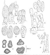Image result for Phyllosticta beaumarisii