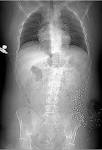 <b>Penetrating</b> abdominal <b>injury</b>.