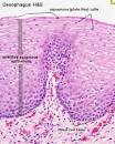 The border between <b>epithelium</b>