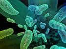 Are all <b>bacterial infections</b>
